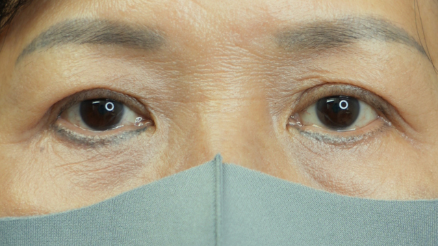 Postoperative Condition Part 1