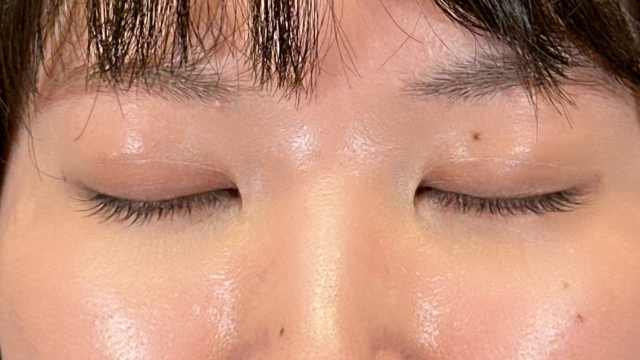 Postoperative Condition Part 1