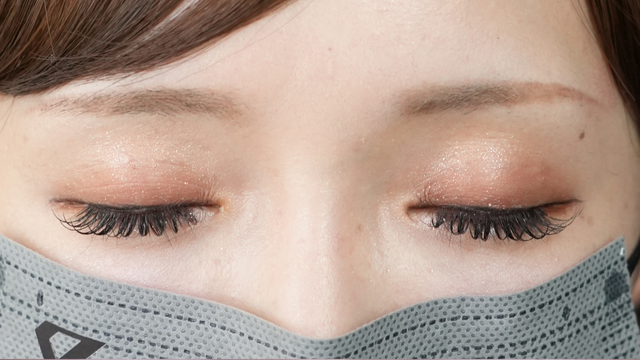 Postoperative Condition Part 1