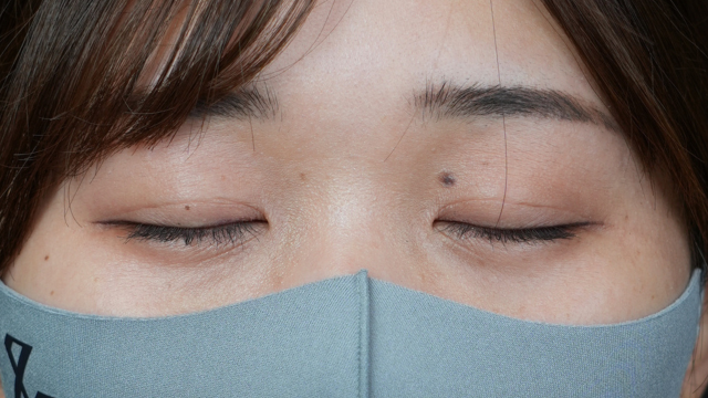 Postoperative Condition Part 1