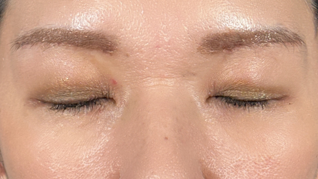 Postoperative Condition Part 1