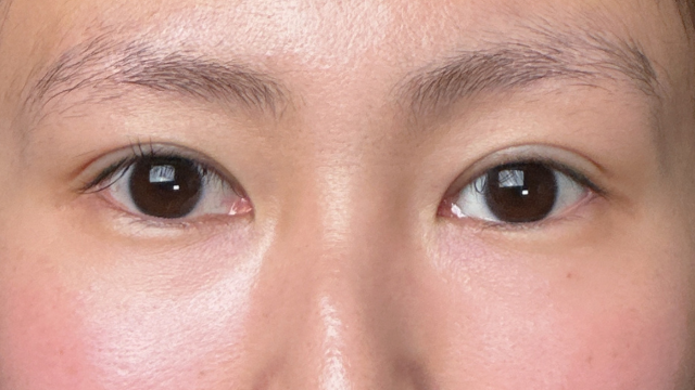 Postoperative Condition Part 1