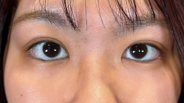 Postoperative Condition Part 1