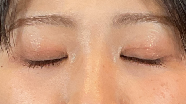 Postoperative Condition Part 1