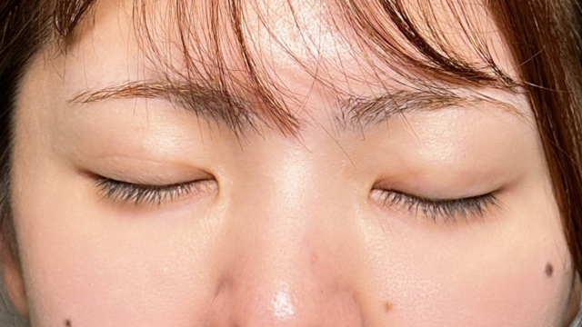 Postoperative Condition Part 1