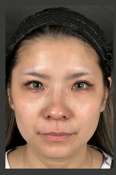 手術前の状態 その1