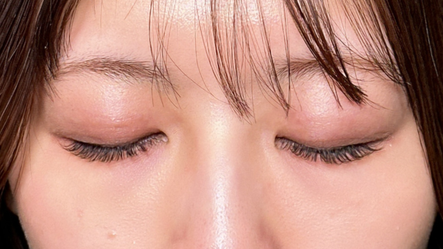 Postoperative Condition Part 1