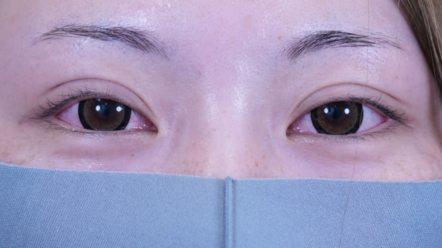 Postoperative Condition Part 1