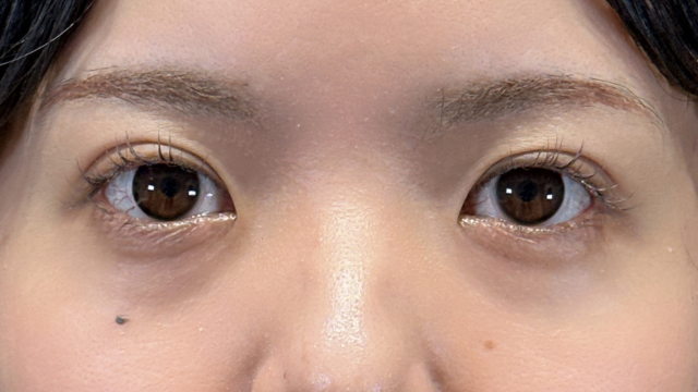 Postoperative Condition Part 1