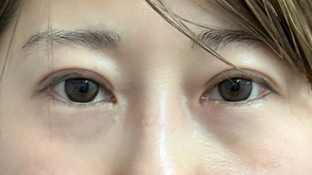 Postoperative Condition Part 1