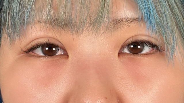 Postoperative Condition Part 1