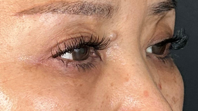 Postoperative Condition Part 1