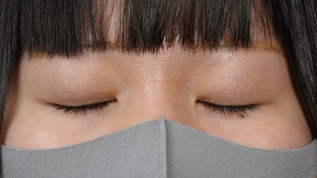 Postoperative Condition Part 1