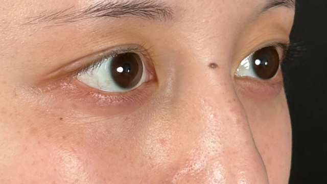 Postoperative Condition Part 1