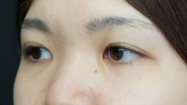 Postoperative Condition Part 1