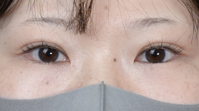 Postoperative Condition Part 1