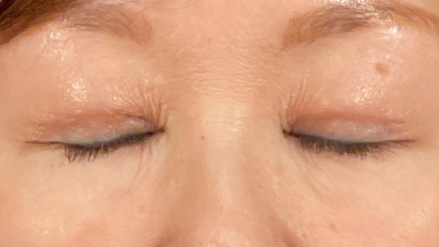 Postoperative Condition Part 1