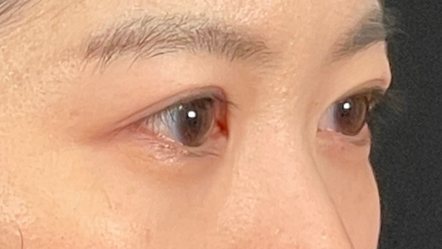 Postoperative Condition Part 1