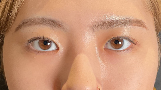 Postoperative Condition Part 1