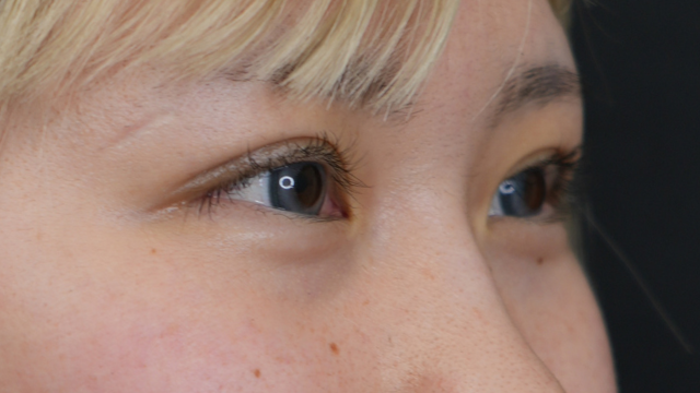 Postoperative Condition Part 1