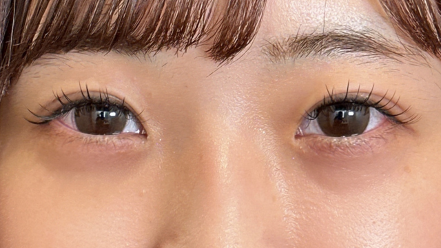 Postoperative Condition Part 1