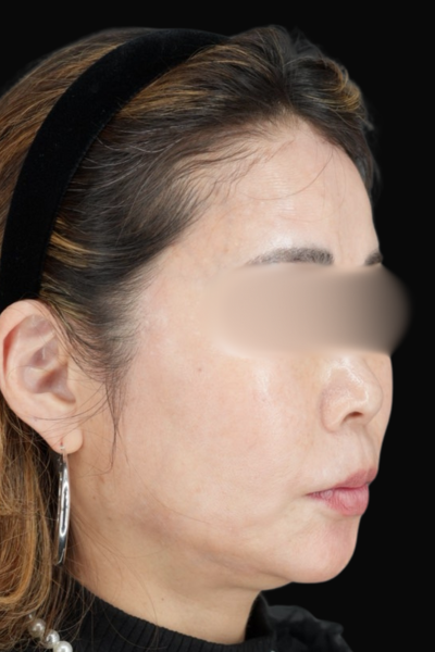 Postoperative Condition Part 1