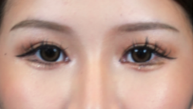 Postoperative Condition Part 1