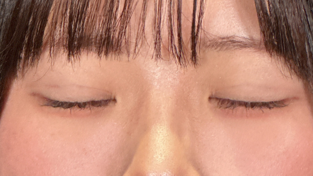 Postoperative Condition Part 1