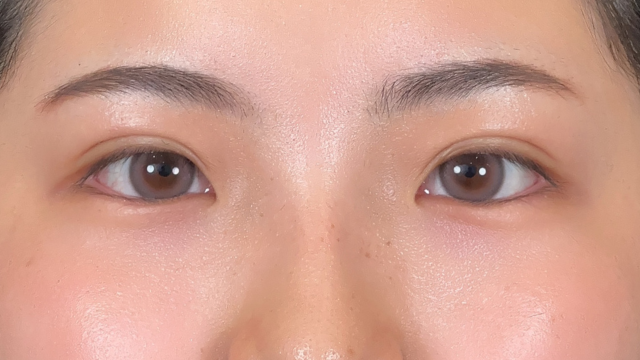 Postoperative Condition Part 1