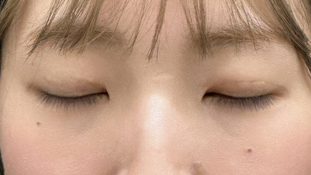 Postoperative Condition Part 1