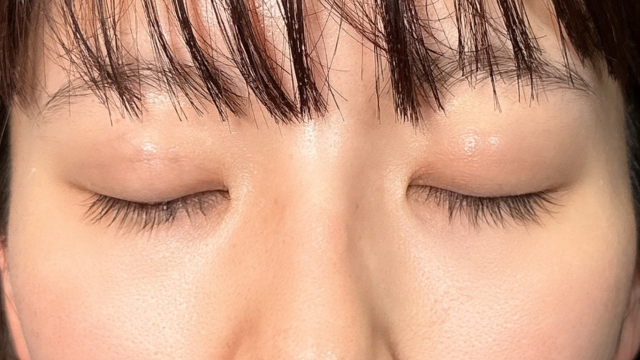 Postoperative Condition Part 1