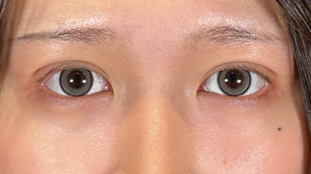 Postoperative Condition Part 1