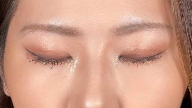 Postoperative Condition Part 1