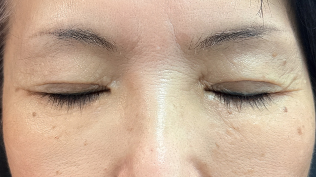 Postoperative Condition Part 1