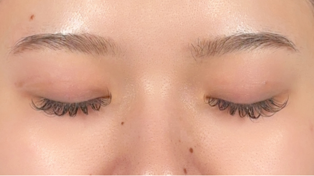 Postoperative Condition Part 1