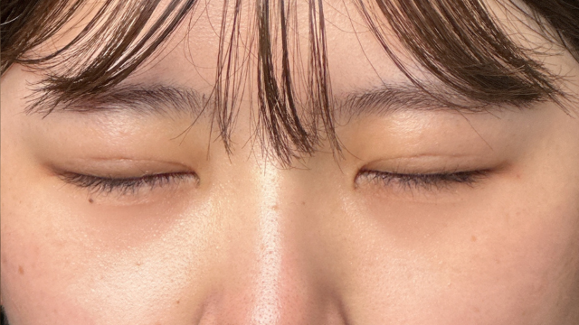 Postoperative Condition Part 1