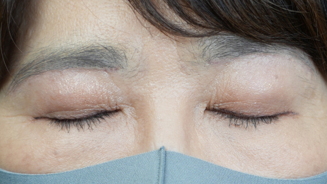 Postoperative Condition Part 1