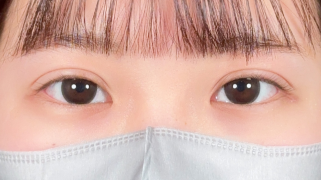 Postoperative Condition Part 1