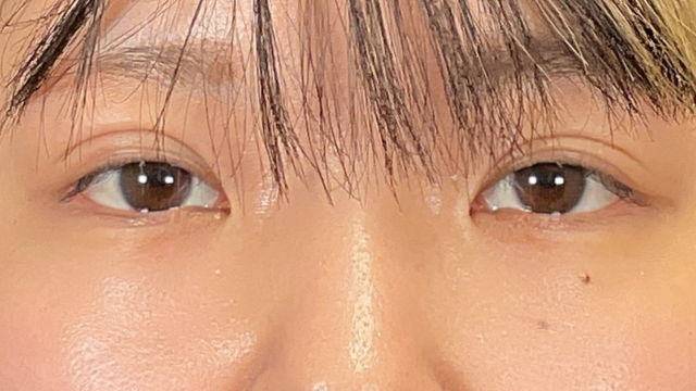 Postoperative Condition Part 1