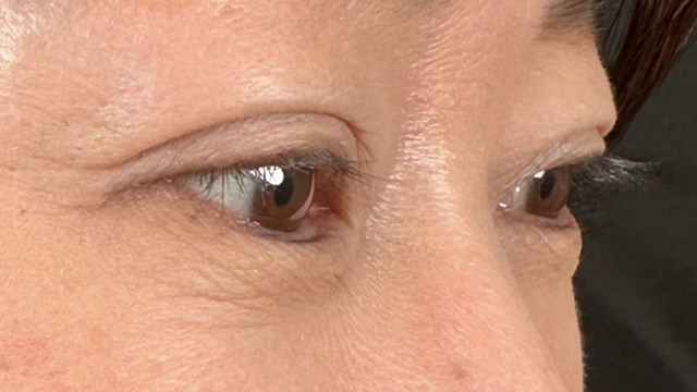 Postoperative Condition Part 1