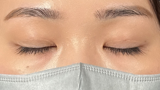 Postoperative Condition Part 1