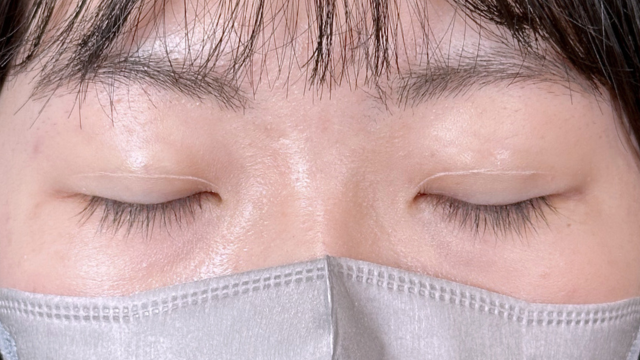 Postoperative Condition Part 1