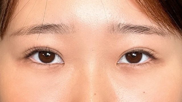 Postoperative Condition Part 1