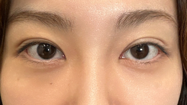 Postoperative Condition Part 1