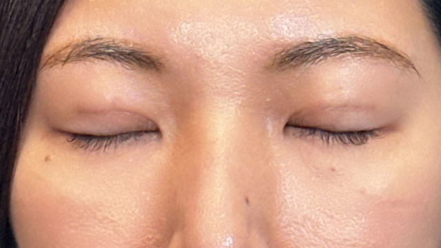 Postoperative Condition Part 1