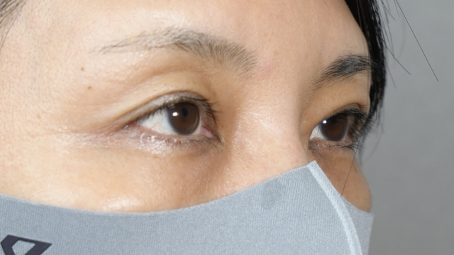 Postoperative Condition Part 1