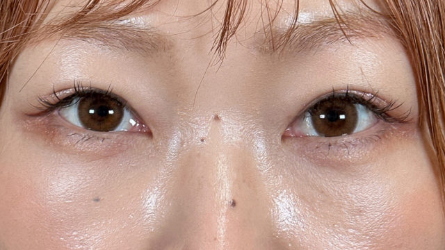 Postoperative Condition Part 1