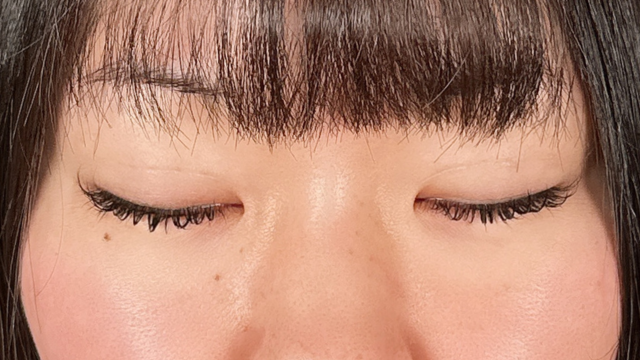 Postoperative Condition Part 1