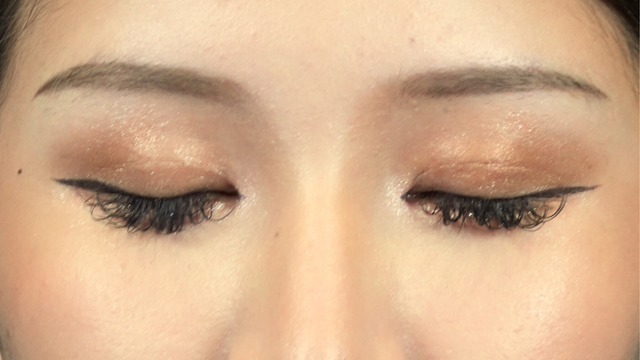 Postoperative Condition Part 1