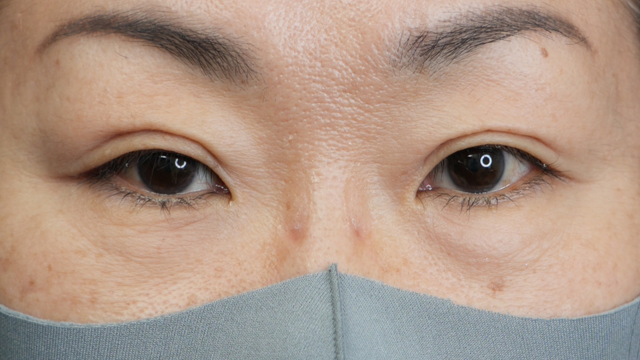 Postoperative Condition Part 1